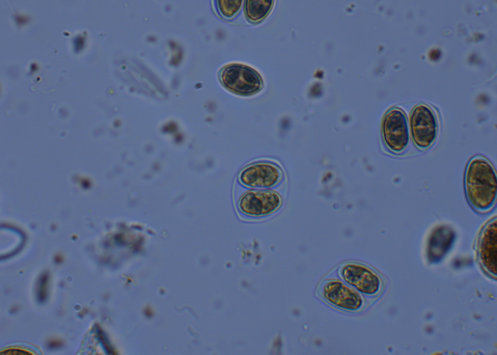 2.1.Oocystis sp