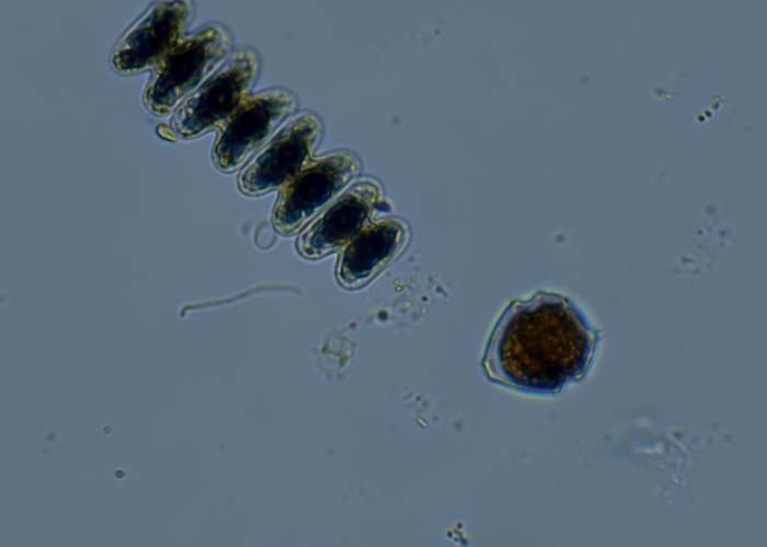 4.1. Peridinium umbonatum